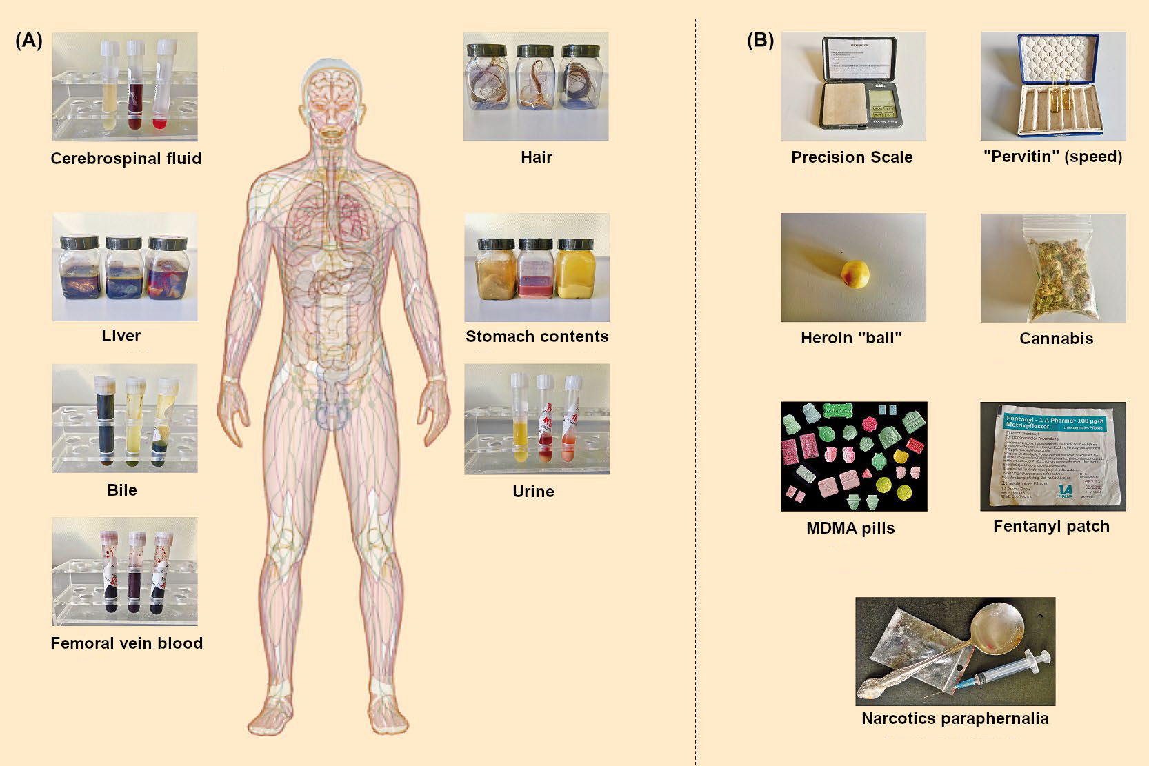 When Corpses Meet Forensic Pathologists – Part 1 :: ChemViews Magazine ...