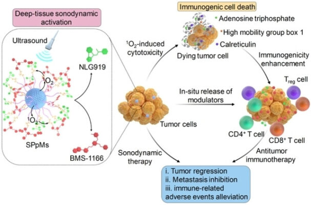 Deep-Tissue Sono-immunotherapy of Orthotopic Pancreatic Cancer ...