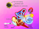 Magnetic Nanoagents for Hearing Loss Treatment