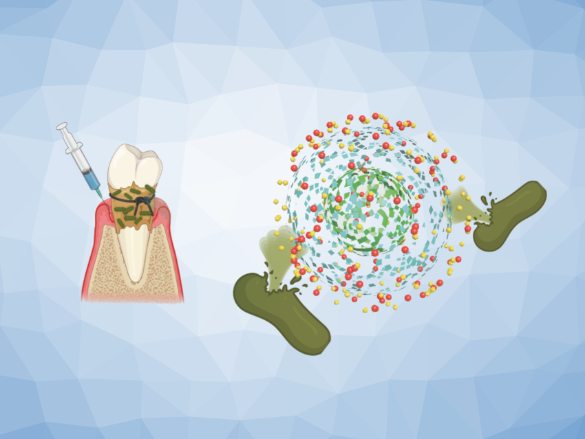 Polyglycerol Nanogels for Periodontitis Treatment