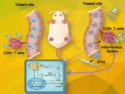 Optimized Sonodynamic Therapy for Inhibiting Tumor Resistance and Development